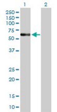 Anti-ENTPD4 antibody produced in mouse purified immunoglobulin, buffered aqueous solution