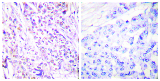 Anti-RAD17 antibody produced in rabbit affinity isolated antibody