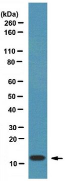 Anti-FSP1/S100A4 Antibody from rabbit