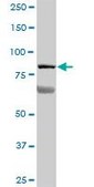 Anti-LOH11CR2A antibody produced in mouse purified immunoglobulin, buffered aqueous solution