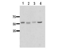 Anti-UGT1a1 Antibody serum, Chemicon®