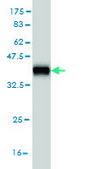 Monoclonal Anti-AKR1D1 antibody produced in mouse clone 1C2, purified immunoglobulin, buffered aqueous solution