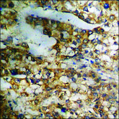 Anti-phospho-ATF2 (pThr69 or 51) antibody produced in rabbit affinity isolated antibody