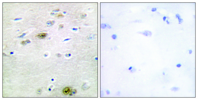 Anti-TRA-2 &#945; antibody produced in rabbit affinity isolated antibody