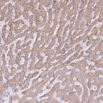 Anti-HSD17B7 antibody produced in rabbit Prestige Antibodies&#174; Powered by Atlas Antibodies, affinity isolated antibody, buffered aqueous glycerol solution