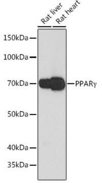 Anti-PPAR&#947; Antibody, clone 9P1J6, Rabbit Monoclonal