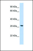 Anti-LYPLA2 antibody produced in rabbit affinity isolated antibody
