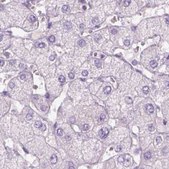 Anti-KRT25 antibody produced in rabbit Prestige Antibodies® Powered by Atlas Antibodies, affinity isolated antibody