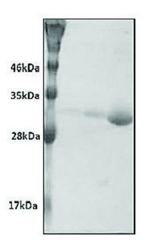 Nicotinamide N-Methyltransferase (hNNMT) human recombinant, expressed in E. coli, &#8805;98% (SDS-PAGE)