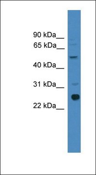 Anti-ZMAT2 antibody produced in rabbit affinity isolated antibody