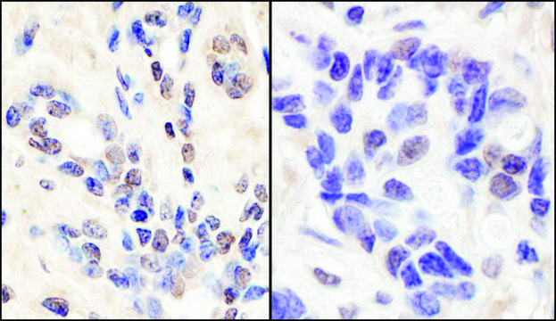 Rabbit anti-BRCA1 Antibody, Affinity Purified Powered by Bethyl Laboratories, Inc.