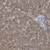 Anti-NQO2 antibody produced in rabbit Prestige Antibodies® Powered by Atlas Antibodies, affinity isolated antibody, buffered aqueous glycerol solution, Ab2