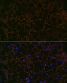 Anti-Perilipin A antibody produced in rabbit