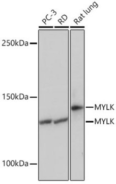 Anti-MYLK Antibody, clone 1J2U2, Rabbit Monoclonal