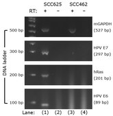 MLM.3 Mouse Lung Metastasis Cell Line