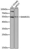 Anti-SMARCE1 antibody produced in rabbit