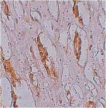 Anti-ZIP-1 Antibody from rabbit, purified by affinity chromatography
