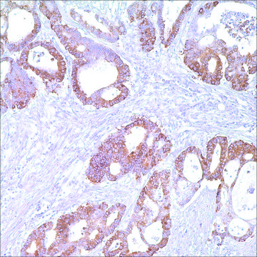 COX-2 (SP21) Rabbit Monoclonal Antibody