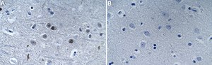 Anti-PHF20 Antibody, clone 1N6 ZooMAb® Rabbit Monoclonal recombinant, expressed in HEK 293 cells