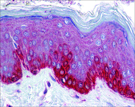 Anti-FZD4 antibody produced in rabbit affinity isolated antibody