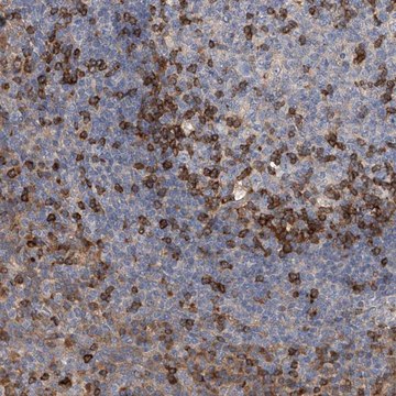 Anti-IPCEF1 antibody produced in rabbit Prestige Antibodies&#174; Powered by Atlas Antibodies, affinity isolated antibody, buffered aqueous glycerol solution