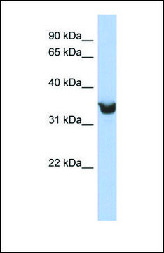 Anti-DLK1 antibody produced in rabbit affinity isolated antibody