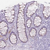 Anti-GAL3ST2 antibody produced in rabbit Prestige Antibodies® Powered by Atlas Antibodies, affinity isolated antibody, buffered aqueous glycerol solution