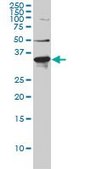 Monoclonal Anti-LDLRAP1 antibody produced in mouse clone 4G4-D5, purified immunoglobulin, buffered aqueous solution