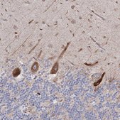 Anti-NHLRC2 antibody produced in rabbit Prestige Antibodies® Powered by Atlas Antibodies, affinity isolated antibody, buffered aqueous glycerol solution
