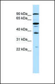 Anti-EZH1, (N-terminal) antibody produced in rabbit affinity isolated antibody