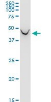 Monoclonal Anti-BCAT1 antibody produced in mouse clone 1F8, purified immunoglobulin, buffered aqueous solution