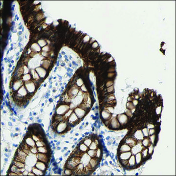 Anti-TBX20 antibody produced in rabbit Prestige Antibodies&#174; Powered by Atlas Antibodies, affinity isolated antibody, buffered aqueous glycerol solution