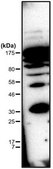 Anti-Phosphohistidine (pHis) from rabbit, purified by affinity chromatography