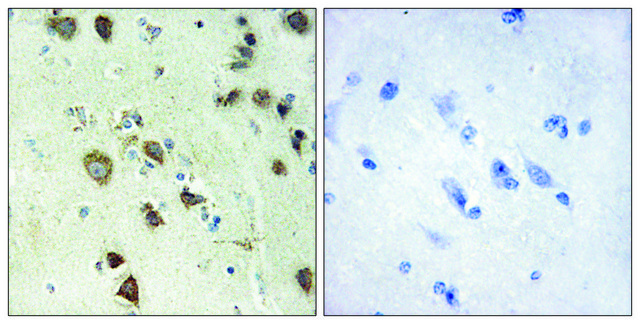 Anti-S6K-&#945;6 antibody produced in rabbit affinity isolated antibody