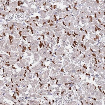 Anti-MUM1 antibody produced in rabbit Prestige Antibodies&#174; Powered by Atlas Antibodies, affinity isolated antibody, buffered aqueous glycerol solution