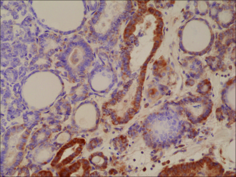 Anti-MUM1/IRF4 antibody, Rabbit monoclonal recombinant, expressed in HEK 293 cells, clone RM352, purified immunoglobulin