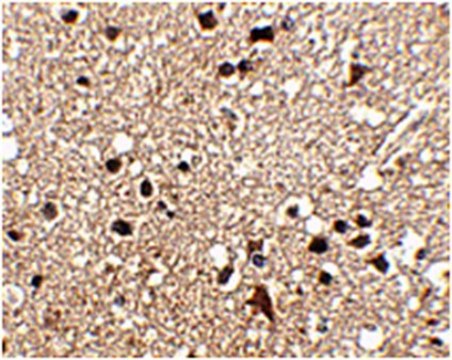 Anti-JPH3 Antibody from rabbit, purified by affinity chromatography