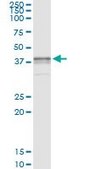 Monoclonal Anti-BST1 antibody produced in mouse clone 4C2, purified immunoglobulin, buffered aqueous solution