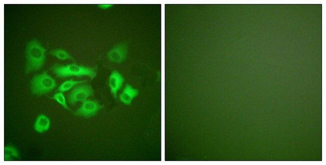 Anti-Keratin 10 antibody produced in rabbit affinity isolated antibody