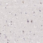 抗-LRG1 兔抗 Ab2, Prestige Antibodies® Powered by Atlas Antibodies, affinity isolated antibody, buffered aqueous glycerol solution