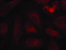 Anti-phospho-ABL1/ABL2 (pTyr393/429) antibody produced in rabbit affinity isolated antibody