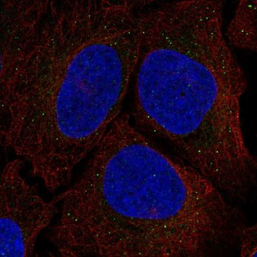 Anti-SRR antibody produced in rabbit Prestige Antibodies&#174; Powered by Atlas Antibodies, affinity isolated antibody