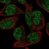 Anti-POLK antibody produced in rabbit Prestige Antibodies® Powered by Atlas Antibodies, affinity isolated antibody