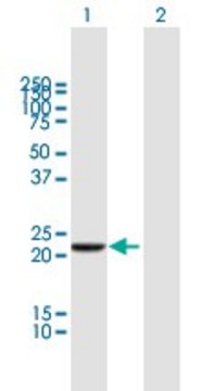 Anti-DTYMK antibody produced in mouse purified immunoglobulin, buffered aqueous solution