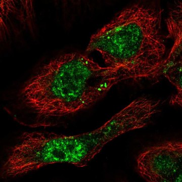 Anti-PHF7 antibody produced in rabbit Prestige Antibodies&#174; Powered by Atlas Antibodies, affinity isolated antibody, buffered aqueous glycerol solution