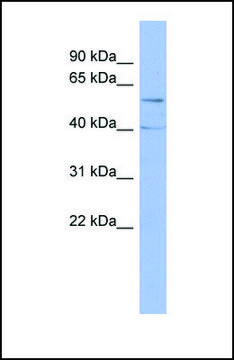 Anti-PPP2R5C antibody produced in rabbit affinity isolated antibody