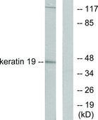 Anti-Keratin 19 antibody produced in rabbit affinity isolated antibody