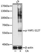 Anti-Phospho-YAP1-S127 antibody produced in rabbit