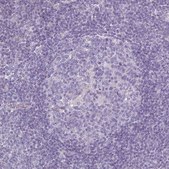 Anti-HOXC13 antibody produced in rabbit Prestige Antibodies® Powered by Atlas Antibodies, affinity isolated antibody, buffered aqueous glycerol solution