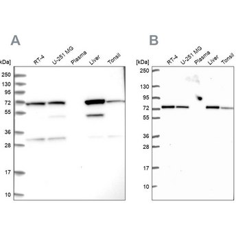 Anti-SDHA antibody produced in rabbit Prestige Antibodies&#174; Powered by Atlas Antibodies, affinity isolated antibody, buffered aqueous glycerol solution